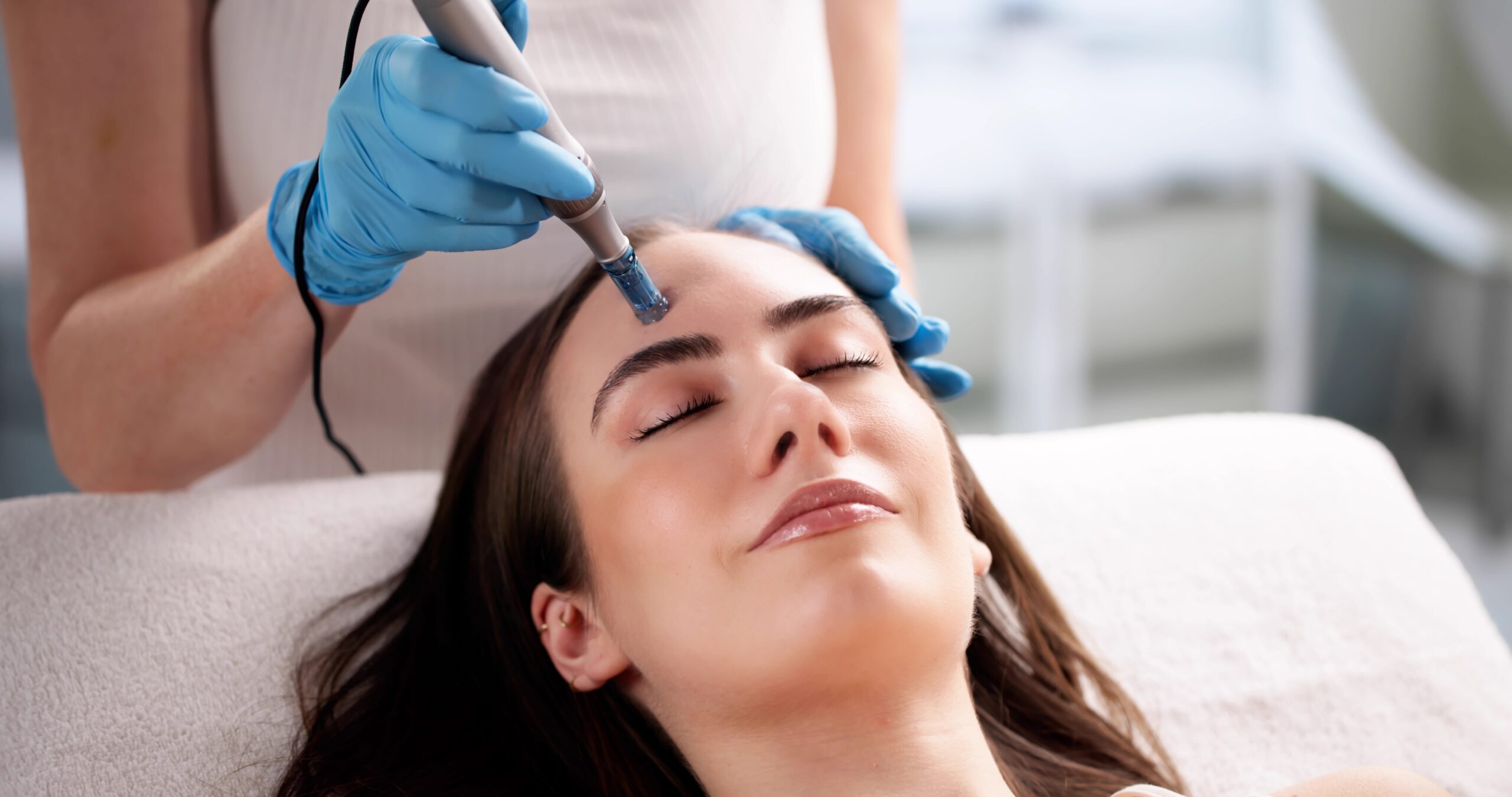 Microneedling 60 minuter